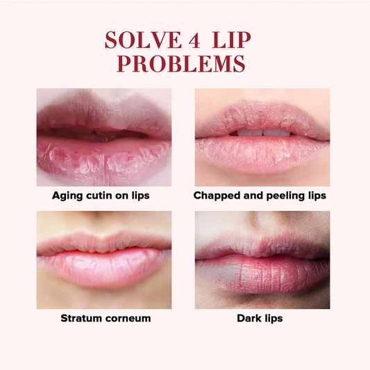 Rose Cherry Honey Peach Lipstick Moisturizing Lip Mask, Unisex Lip